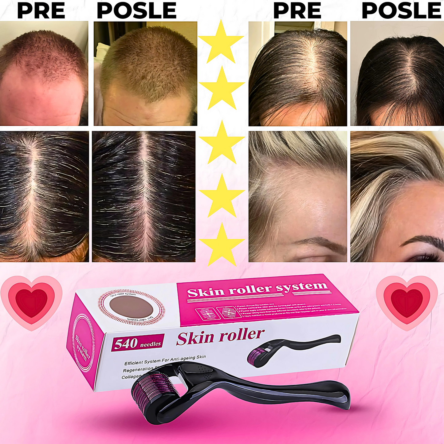 Derma Roler za kompletnu negu tela